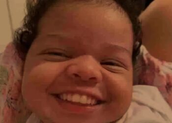 Miraculous Arrival: Infant Emerges Beaming With Full Set Of Teeth