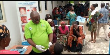 FMC Keffi: CFDF Gives Free Cleft, Craniofacial Surgery