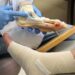 Vascular Surgeons, Diabetic Foot Care Proffers Solutions On Limb Salvage, Amputation Prevention