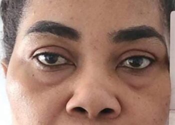 Toronto Police Arrest Canadian-Nigerian Woman for Threatening Yoruba, Benin Communities
