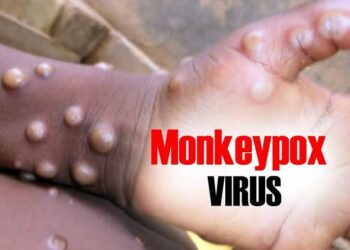 Mpox still not under control in Africa – Africa CDC