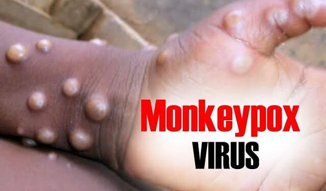 Mpox still not under control in Africa – Africa CDC