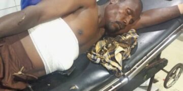 Abuja Herbalist Injures Himself While Testing ‘Bulletproof’ Charm
