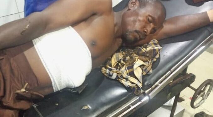 Abuja Herbalist Injures Himself While Testing ‘Bulletproof’ Charm