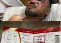 British National Survives Horrific Air India Crash Against All Odds