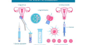 21,000 Babies Born in 2023 Through IVF in UK