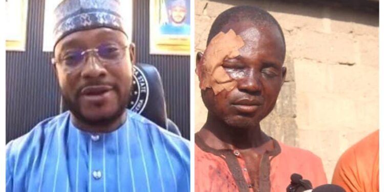 Gusau Protest: Banga Residents Brutalised as Gov Lawal Ignores Insecurity