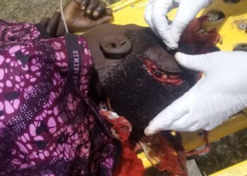 Outrage As Barau Dikko Teaching Hospital Halts Treatment For Attack Victims