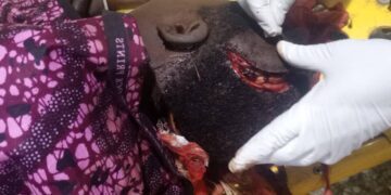 Outrage As Barau Dikko Teaching Hospital Halts Treatment For Attack Victims