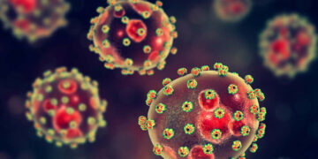 Deadly Lassa Fever Strikes Plateau, Leaving Four Dead