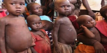 EU Support Helps 40,000 Malnourished Children in Yobe
